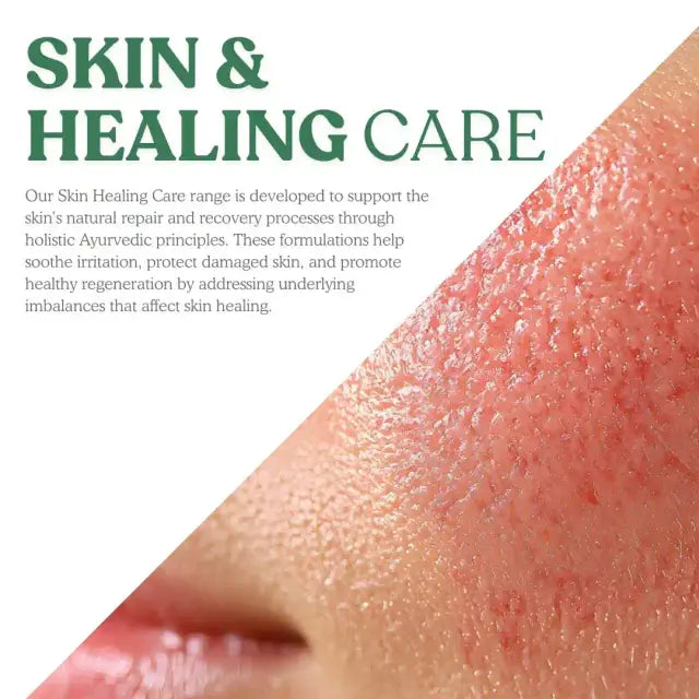 Ayurvedic Medicine For Skin & Healing Care